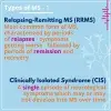 Type of MS